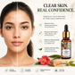 Scar Removal Serum (Pure Mix of Sandalwood Oil, Steam Distilled Neem & Fenugreek Extract) - Reduces Acne, Dark Spots & Pigmentation (Pack of 2 x 10 ml)