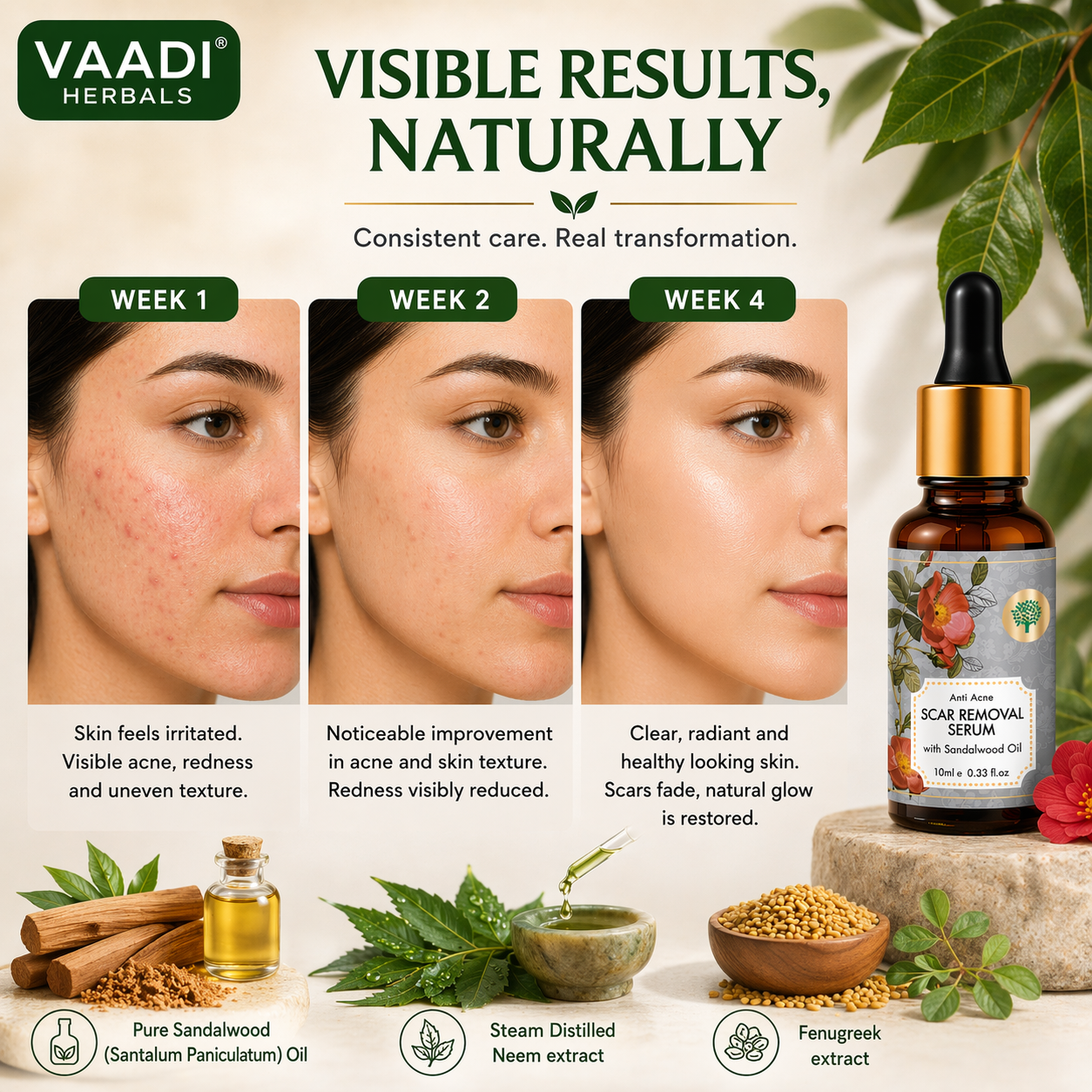Scar Removal Serum (Pure Mix of Sandalwood Oil, Steam Distilled Neem & Fenugreek Extract) - Reduces Acne, Dark Spots & Pigmentation (Pack of 2 x 10 ml)